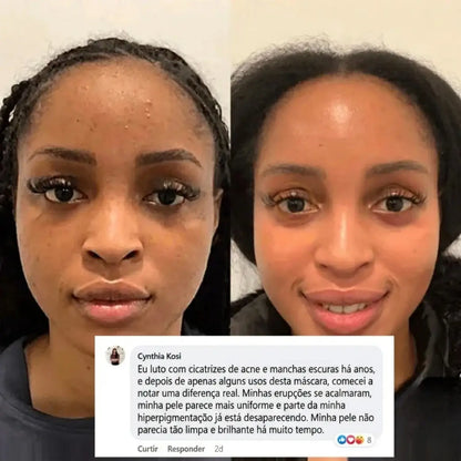 Máscara Coreana Noturna Envelopante de Colágeno Anti-Idade (#1 Mais Vendido)